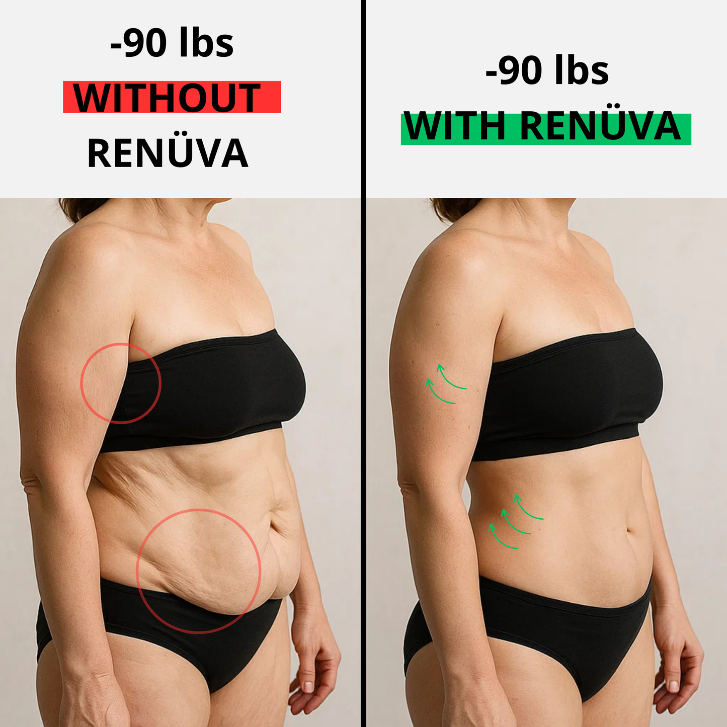 The RENÜVA CoreLift™ Belt