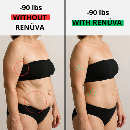 The RENÜVA CoreLift™ Belt